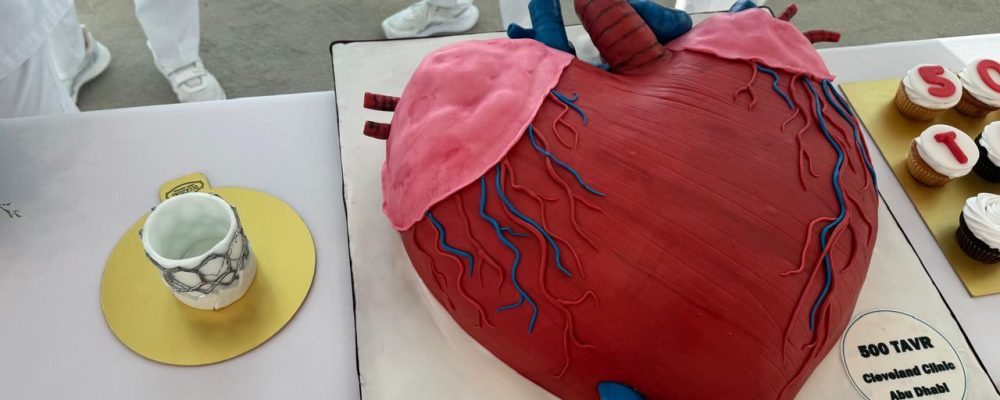 Cleveland Clinic Abu Dhabi Celebrates 500 TAVI Procedures, Pioneering Cardiovascular Care In The UAE